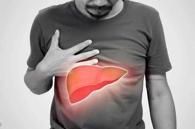 Fatty Liver