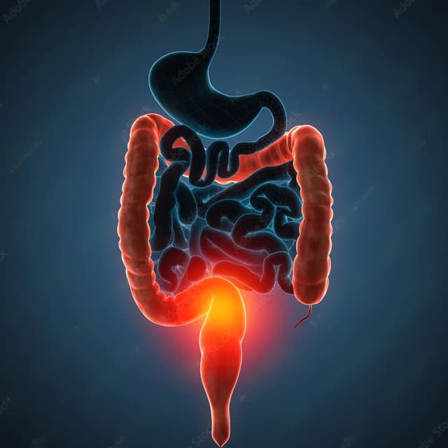 IBD