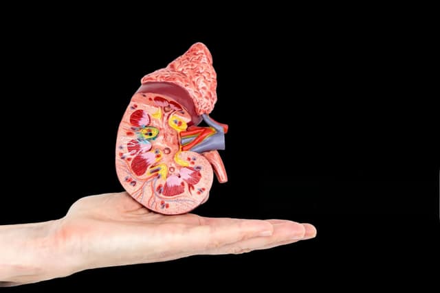 Kidney Stone